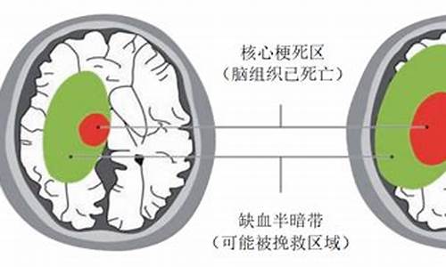 猝不及防的意思_猝不及防的意思解释词语