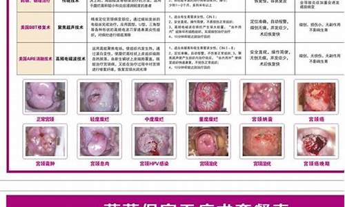 六盘水宫颈疾病治疗哪家好_六盘水宫颈疾病治疗