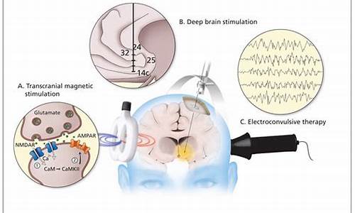 劲颅磁能治疗癫痫吗-颈颅磁对大脑有伤害吗