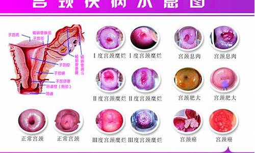 南溪宫颈疾病_南溪宫颈疾病医院电话