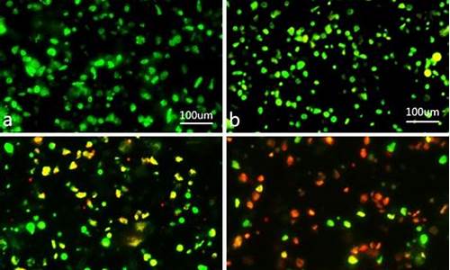 吖啶橙荧光染色可否鉴定细胞活-吖啶橙荧光