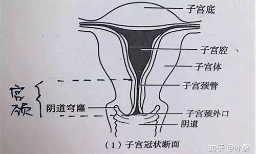 宫颈能不全是什么原因造成的?_宫颈疾病不包括宫颈下移对吗