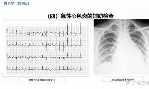 心包结核症状_心包结核病例有哪些