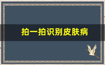 拍一拍识别皮肤病(扫一扫识别皮肤病)_https://www.brunchezvous.com_旅游景点_第1张