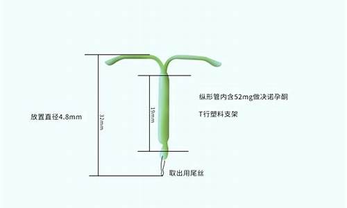 第 1 个：曼月乐尾丝是金属材料(曼月乐环尾丝是金属吗)