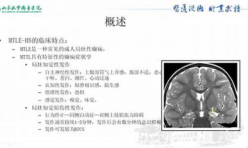 边缘叶功能-治疗边缘叶癫痫的中药