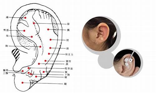 癫耳鸣有什么症状-癫痫耳穴治疗