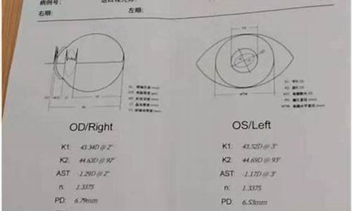 眼科检查报告单怎么看ps_眼科检查报告单怎么看AL