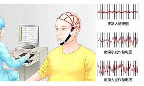 脑电波能查出什么-脑电波检查可以查癫痫吗