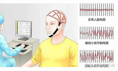 轻微癫症状能自愈-轻微癫痫做什么检查