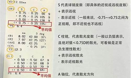 配眼镜的单子怎么看度数?怎么配?_配镜度数怎么看懂